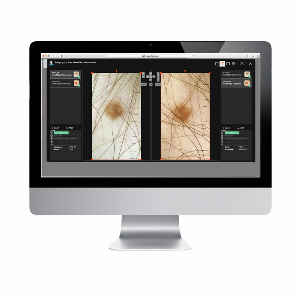 HEINE DERManager 2.0