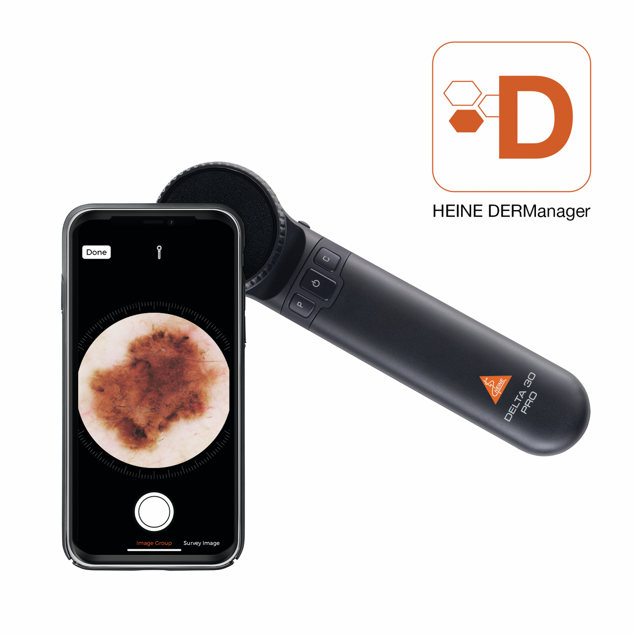 The image shows a HEINE DELTA 30 PRO dermatoscope alongside a smartphone displaying a skin examination. The device is designed for precise dermatological assessments, featuring advanced imaging capabilities.
