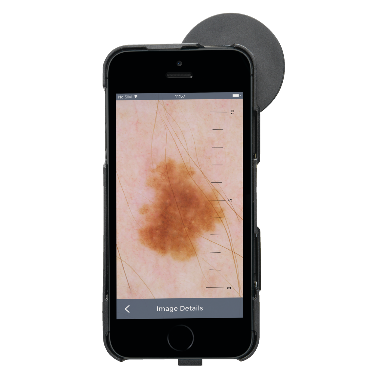 HEINE iC1 Dermatoscope