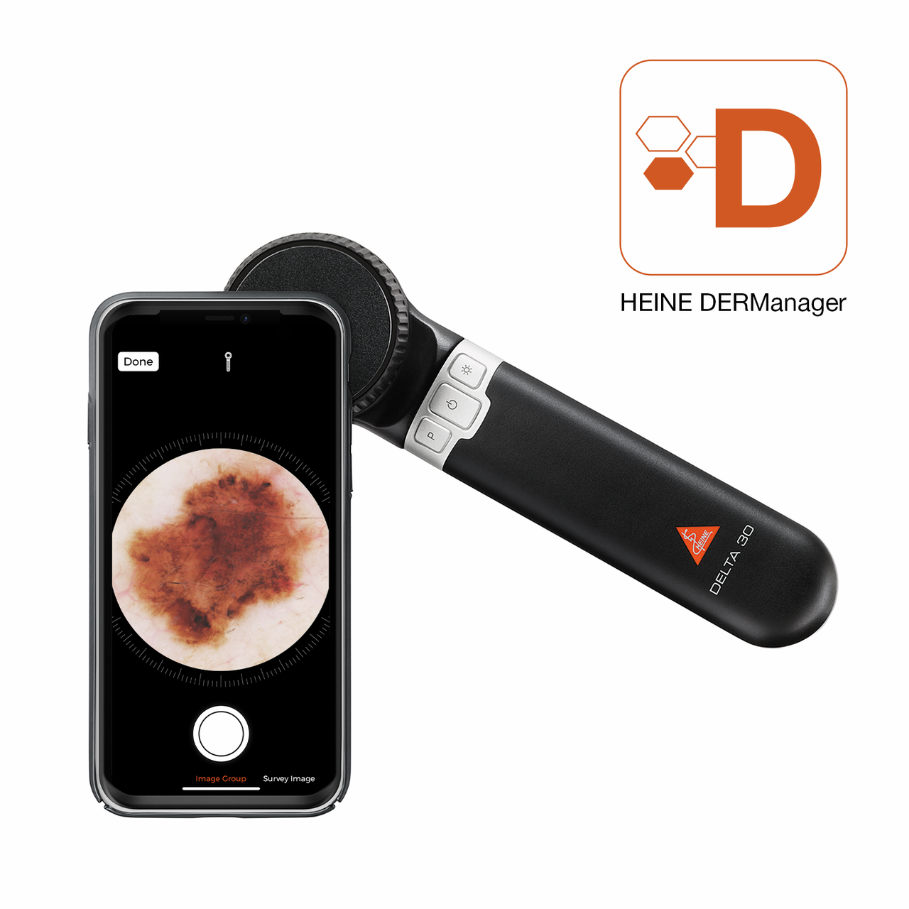 HEINE DELTA 30 Dermatoscope